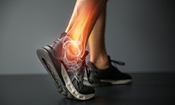 Comparing Total Ankle Replacement to Ankle Fusion