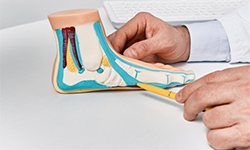 Flat Feet, Real Problems: How Flatfoot Surgery Can Restore Your Step