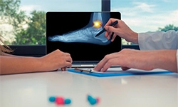 Managing Arthritis in the Ankle and Foot: When Conservative Treatments Aren't Enough