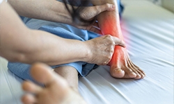 Stress Fractures in the Foot: Symptoms You Might Be Missing