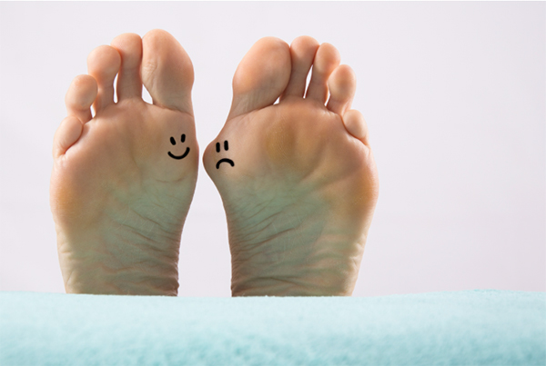 Bunion Surgery Recovery Timeline: What to Expect Week by Week