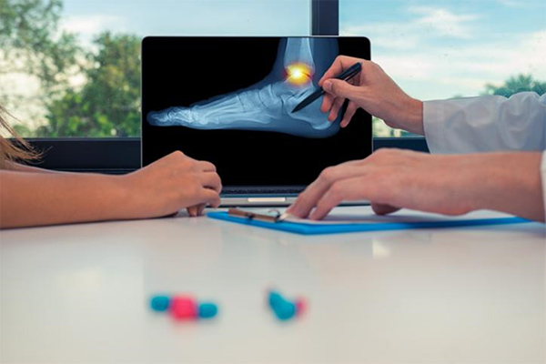Managing Arthritis in the Ankle and Foot: When Conservative Treatments Aren't Enough
