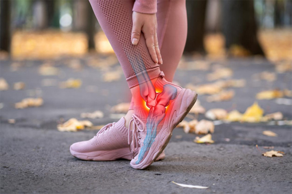 How Your Workout Shoes Could Be Causing Foot Pain
